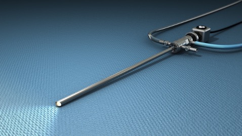 Arthroscopy and Sports medicine in coimbatore